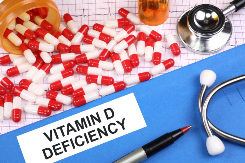 Vitamin D deficiency sign